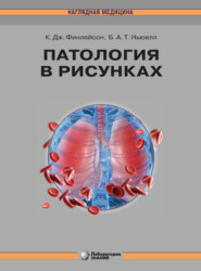 бесплатно читать книгу Патология в рисунках автора Барри Ньюелл