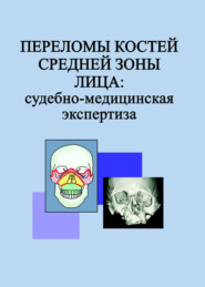 бесплатно читать книгу Переломы костей средней зоны лица: судебно-медицинская экспертиза автора Людмила Гришенкова