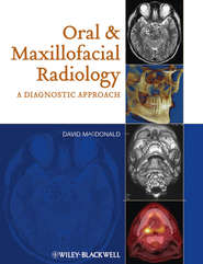 бесплатно читать книгу Oral and Maxillofacial Radiology. A Diagnostic Approach автора David Macdonald