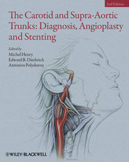 бесплатно читать книгу The Carotid and Supra-Aortic Trunks. Diagnosis, Angioplasty and Stenting автора Michel Henry