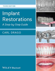 бесплатно читать книгу Implant Restorations. A Step-by-Step Guide автора Carl Drago