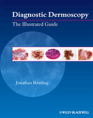 бесплатно читать книгу Diagnostic Dermoscopy. The Illustrated Guide автора Jonathan Bowling