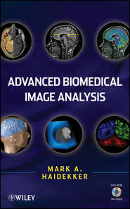 бесплатно читать книгу Advanced Biomedical Image Analysis автора Mark Haidekker