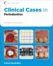 бесплатно читать книгу Clinical Cases in Periodontics автора Nadeem Karimbux