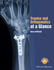 бесплатно читать книгу Trauma and Orthopaedics at a Glance автора Henry Willmott