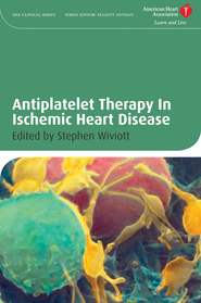бесплатно читать книгу Antiplatelet Therapy In Ischemic Heart Disease автора Stephen Wiviott