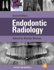 бесплатно читать книгу Endodontic Radiology автора Bettina Basrani