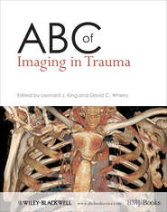 бесплатно читать книгу ABC of Imaging in Trauma автора Wherry David