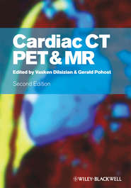 бесплатно читать книгу Cardiac CT, PET and MR автора Pohost Gerald