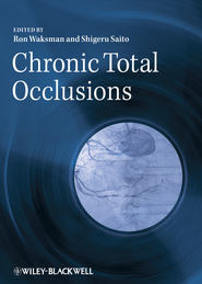 бесплатно читать книгу Chronic Total Occlusions. A Guide to Recanalization автора Saito Dr.
