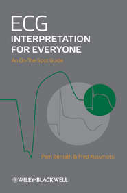 бесплатно читать книгу ECG Interpretation for Everyone. An On-The-Spot Guide автора Kusumoto Fred