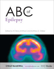 бесплатно читать книгу ABC of Epilepsy автора Smithson W.