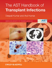бесплатно читать книгу The AST Handbook of Transplant Infections автора Humar Atul