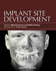 бесплатно читать книгу Implant Site Development автора Sonick Michael