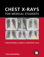 бесплатно читать книгу Chest X-rays for Medical Students автора Clarke Christopher