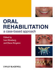 бесплатно читать книгу Oral Rehabilitation. A Case-Based Approach автора Klineberg Iven