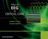 бесплатно читать книгу Atlas of EEG in Critical Care автора Brenner Richard
