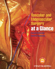 бесплатно читать книгу Vascular and Endovascular Surgery at a Glance автора Stephenson Matthew