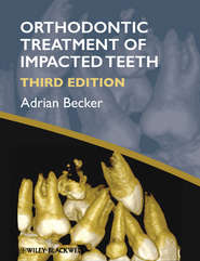бесплатно читать книгу Orthodontic Treatment of Impacted Teeth автора Adrian Becker