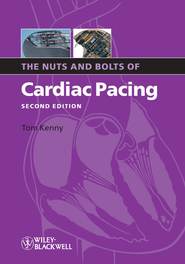 бесплатно читать книгу The Nuts and Bolts of Cardiac Pacing автора Tom Kenny