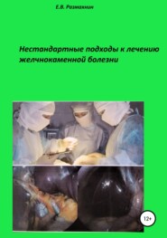 бесплатно читать книгу Нестандартные подходы к лечению желчнокаменной болезни автора Евгений Размахнин
