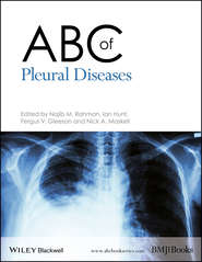 бесплатно читать книгу ABC of Pleural Diseases автора Ian Hunt