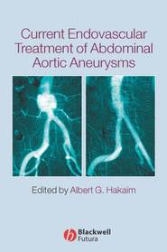 бесплатно читать книгу Current Endovascular Treatment of Abdominal Aortic Aneurysms автора 