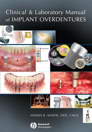 бесплатно читать книгу Clinical and Laboratory Manual of Implant Overdentures автора 