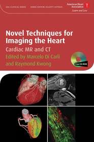 бесплатно читать книгу Novel Techniques for Imaging the Heart автора Marcelo Carli