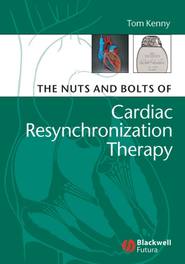 бесплатно читать книгу The Nuts and Bolts of Cardiac Resynchronization Therapy автора 