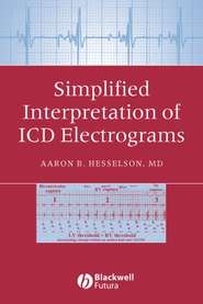 бесплатно читать книгу Simplified Interpretation of ICD Electrograms автора 