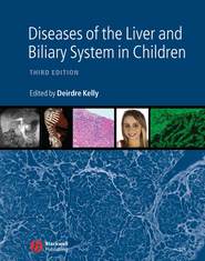 бесплатно читать книгу Diseases of the Liver and Biliary System in Children автора 