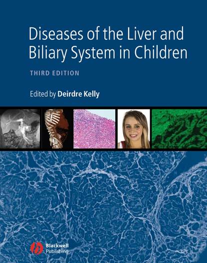 бесплатно читать книгу Diseases of the Liver and Biliary System in Children автора 