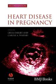 бесплатно читать книгу Heart Disease in Pregnancy автора Celia Oakley