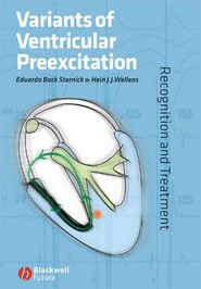 бесплатно читать книгу Variants of Ventricular Preexcitation автора Eduardo Sternick