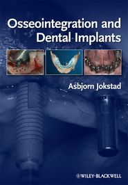 бесплатно читать книгу Osseointegration and Dental Implants автора 