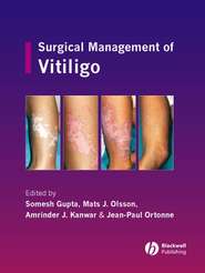 бесплатно читать книгу Surgical Management of Vitiligo автора Somesh Gupta