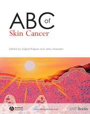 бесплатно читать книгу ABC of Skin Cancer автора Sajjad Rajpar