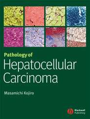 бесплатно читать книгу Pathology of Hepatocellular Carcinoma автора 