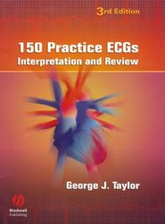 бесплатно читать книгу 150 Practice ECGs автора 