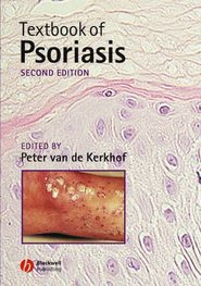 бесплатно читать книгу Textbook of Psoriasis автора Peter C. M. Kerkhof