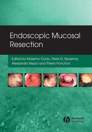 бесплатно читать книгу Endoscopic Mucosal Resection автора Massimo Conio
