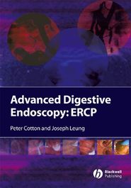 бесплатно читать книгу Advanced Digestive Endoscopy автора Peter Cotton