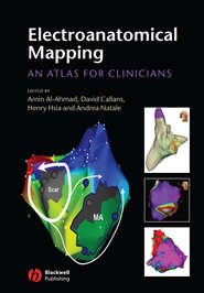 бесплатно читать книгу Electroanatomical Mapping автора Andrea Natale