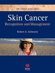 бесплатно читать книгу Skin Cancer автора 
