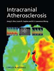бесплатно читать книгу Intracranial Atherosclerosis автора Jong Kim