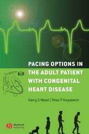 бесплатно читать книгу Pacing Options in the Adult Patient with Congenital Heart Disease автора Harry Mond