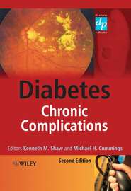 бесплатно читать книгу Diabetes автора Michael Cummings