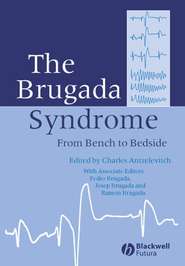 бесплатно читать книгу The Brugada Syndrome автора Charles Antzelevitch