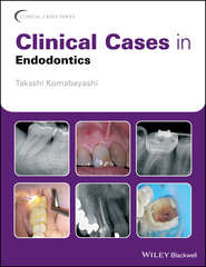 бесплатно читать книгу Clinical Cases in Endodontics автора 
